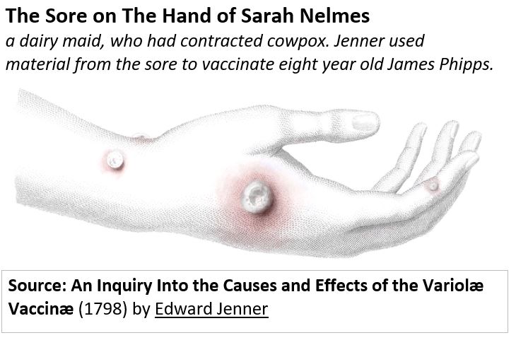 Sarah Nelme's Hand