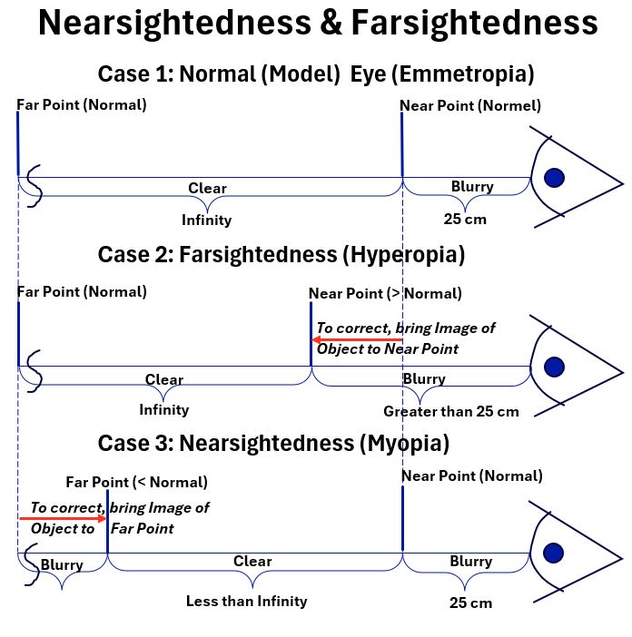 Emmetropia, Hyperopia, Myopia relationships to Far Point and Near Point